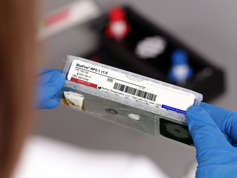 Multiplex PCR cho phép khảo sát nhiều mục tiêu di truyền trong một quy trình xét nghiệm
