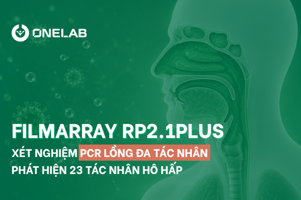 FilmArray RP2.1plus